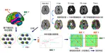 Extended multimodal whole-brain anatomical covariance analysis: detection of disrupted correlation networks related to amyloid deposition