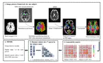 Alteration of brain structural connectivity in progression of Parkinsons disease: A connectome-wide network analysis