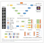 MRF-Net: A multi-branch residual fusion network for fast and accurate whole-brain MRI segmentation