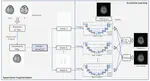 Ensemble learning  via supervision augmentation for white matter hyperintensity segmentation