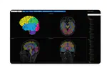 Atlas pre-selection strategies to enhance the efficiency and accuracy of multi-atlas brain segmentation tools