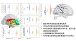 Relationship between neuropsychological behavior and brain white matter in first-episode psychosis