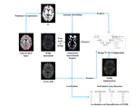 An anatomical knowledge-based MRI deep learning pipeline for white matter hyperintensity quantification associated with cognitive impairment